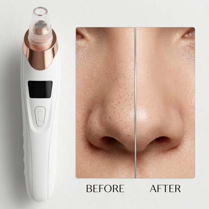 Blackhead Removal Machine -Clear Skin Pro